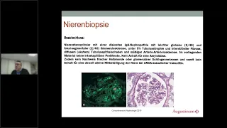 Fallpräsentation aus dem Alltag: Niere – Lunge – Gelenke: Ist es Rheuma – PD Dr. med. Klaus Thürmel