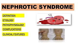 Nephrotic Syndrome | Simplified Overview | Made easy.