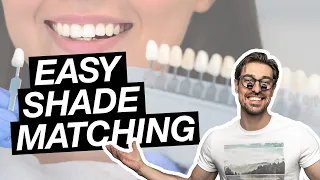 Shade Matching Teeth with Vita Classical