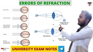 Errors Of Refraction || Special Sense Physiology