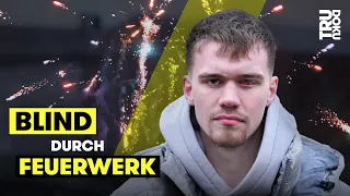 Silvester-Albtraum: Lucas (19) von Feuerwerk getroffen | TRU DOKU