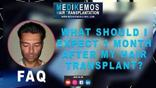 #7 Medikemos  Q/A - What should I expect 1 month after my Hair Transplant?