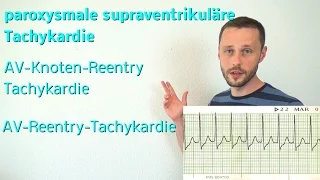 Die supraventrikuläre Tachykardie! AV-Knoten-Reentry und AV-Reentry-Tachykardie