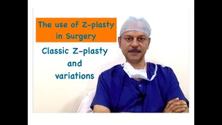 #zplasty All you wanted to know about Z plasty