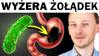 Bakteria H. pylori wyżera żołądek. Te naturalne kuracje ją usuną