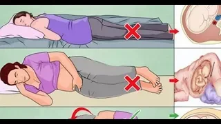 How to sleep during pregnancy || Best  Sleeping Position during pregnancy