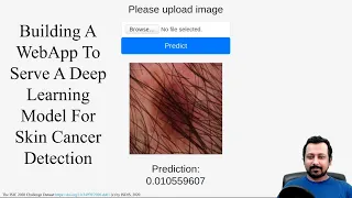 Build a web-app to serve a deep learning model for skin cancer detection