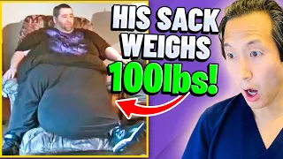 He Has A 100 Lb Scrotum! EXTREME Bodies EXPLAINED!