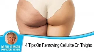 How To Get Rid Of Cellulite On Legs And Thighs