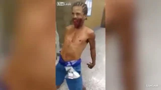 Demon Posessed Zombie Wants to Eat Faces in Rio Guy Terrifies Hospital Staff