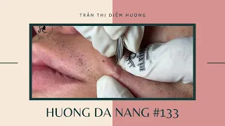 #133 | Huong Da Nang