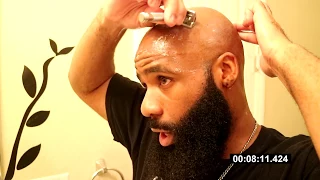 How To Prevent Razor Bumps! & Why You Get Razor Burn!