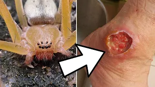 10 Dangerous Animals You Should NEVER Touch!