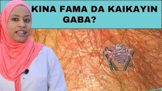 Dr Naima - Kaikayin gaban mace, Radadi, Sabewa - Kada kiyi shiru Yar’uwa.