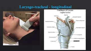 Neck US - Basic Anatomy