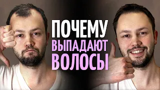 Почему выпадают волосы? Врач косметолог о причинах облысения.