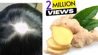 Ginger Juice to Cure Baldness & Regrow New Hair | Sushmita's Diaries