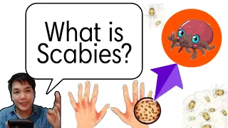 What is Scabies: Is it Fungal, Virus, Bacteria or Parasite? |Nursing Review - NP1