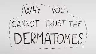 Why you cannot trust the dermatomes