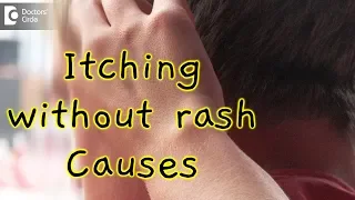 What causes itching all over without a rash? - Dr. Rasya Dixit