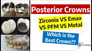 DENTAL CROWN TYPES. Zirconia, Emax, PFZ, PFM, Metal!! Choosing the BEST!