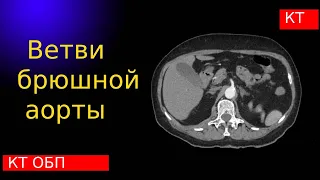 Лучевая анатомия ветвей брюшной аорты.