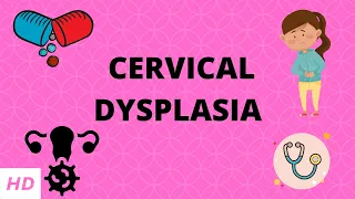 Cervical Dysplasia, Causes, Signs and Symptoms, Diagnosis and Treatment.