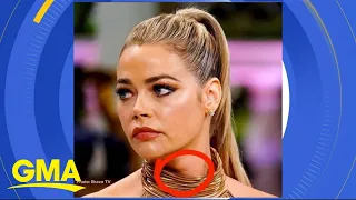Denise Richards treats an enlarged thyroid after fans noticed it on TV l GMA