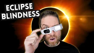 How To Watch A Solar Eclipse Safely - Don't Go Blind!