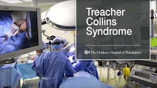 What Is Treacher Collins Syndrome? (9 of 9)