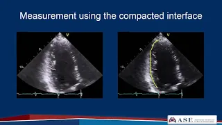 ASE Guidelines for Performing a Comprehensive Echo  in Adults Part 2