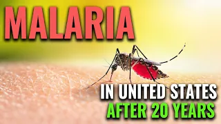 Malaria Cases in US Raises Alarm