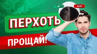 Появилась ПЕРХОТЬ: что делать? Как избавиться от перхоти?