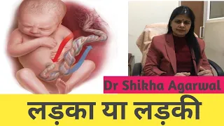 लड़की या लड़की कैसे तय होता है/ How to know it will be Boy or girl/लड़की या लड़की कैसे जाने