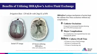 Chris Kellner, MD - Spontaneous Intraventricular Hemorrhage Utilizing IRRAflow with Continuous tPA