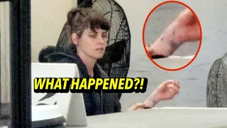 Kristen Stewart Exhibits Apparent Bruises On Wrist At LAX