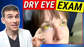 The Most Thorough Dry Eye Examination - Dry Eyes Testing Explained