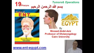 Pharynx 4 (Mosaad Abdel-Aziz): Tumours of the Pharynx & Operations (Tonsillectomy & Adenoidectomy)