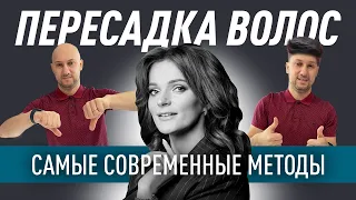 Пересадка волос с бороды? Какие методы самые современные