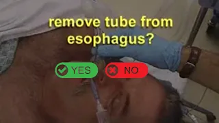 What to do if you suspect ET tube in Esophagus: Endotracheal Intubation