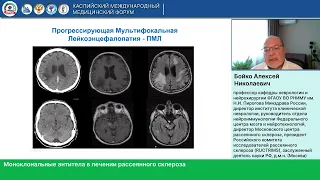 Бойко А.Н. Моноклональные антитела в лечении рассеянного склероза