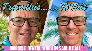 Toothless to Terrific!! AMAZING BALI DENTAL transformation in SANUR