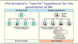 USMLE Question 25 (with answer and explanation) | Retinoblastoma