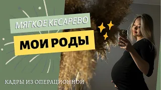 МОИ РОДЫ | МЯГКОЕ КЕСАРЕВО СЕЧЕНИЕ