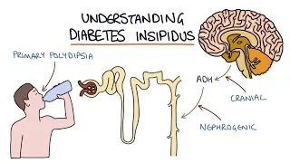 Understanding Diabetes Insipidus