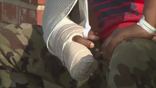 Boy loses finger after fall at Webster Groves school