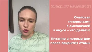 Очаговая гиперплазия с дисплазией в анусе. Питание после закрытия стомы.