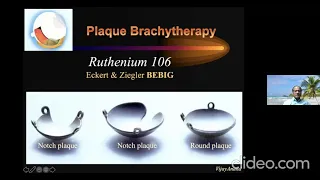 Plaque Brachytherapy in Ophthalmic Tumors_Dr P. Vijay Anand Reddy