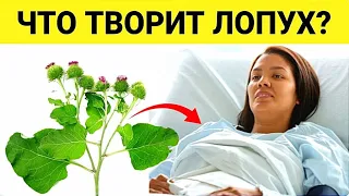 Врачи в шоке! Вот что ЛОПУХ сделал с моим телом. Что творит лопух?