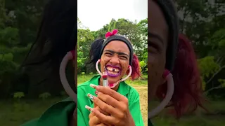 LALY LA FEA (TIPOS DE NIÑOS CUANDO VAN AL MÉDICO)🧑‍⚕️😂😂